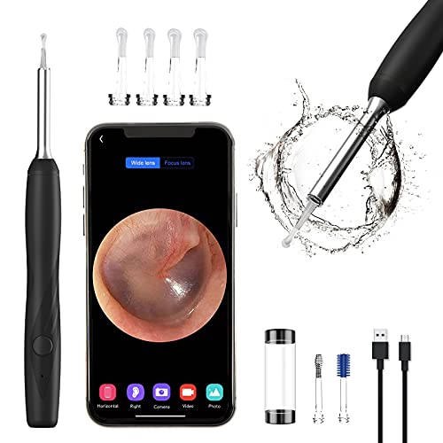 Ear Wax Removal Tool Camera, Earwax Remover Tool, Ear Camera,1600P FHD Wirele...