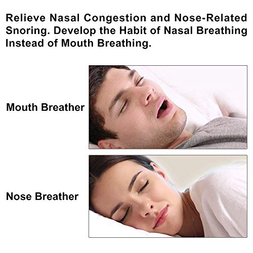 WoodyKnows Super-Support Nasal Dilators