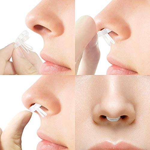 WoodyKnows Super-Support Nasal Dilators