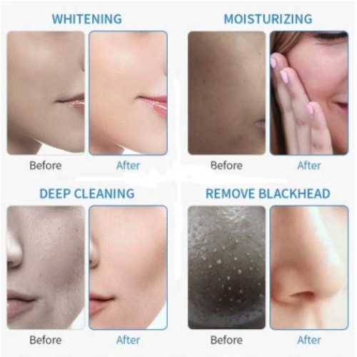 Wrnkl Fre Oxygen Facial Injector - Nano Moisture Spray - Beauty Supplies, Ski...