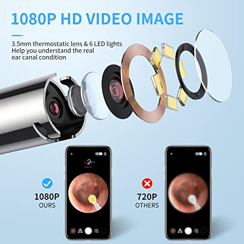 Ear Wax Removal Tool with Endoscope - Xanland Digital Earwax Remover Tool wit...