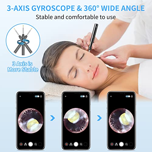Ear Wax Removal Tool with Endoscope - Xanland Digital Earwax Remover Tool wit...