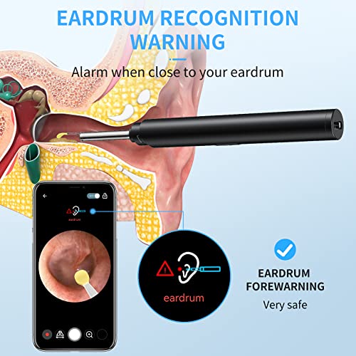 Ear Wax Removal Tool with Endoscope - Xanland Digital Earwax Remover Tool wit...