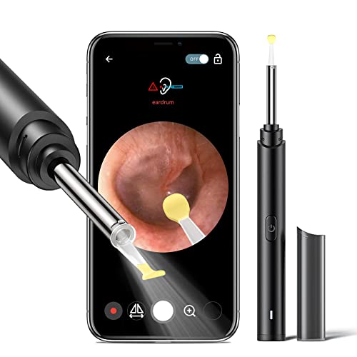 Ear Wax Removal Tool with Endoscope - Xanland Digital Earwax Remover Tool wit...