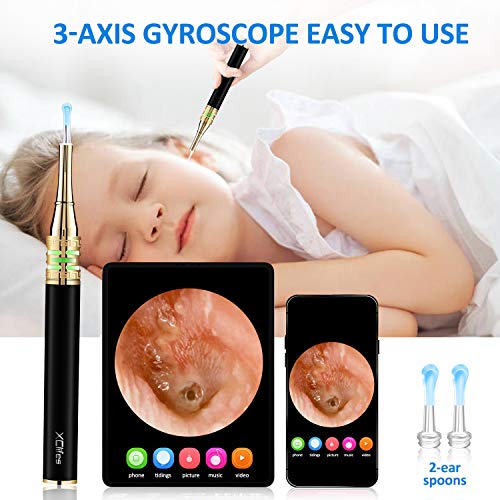 Earwax Removal Endoscope, Earwax Removal Tool, Ear Camera, 1080p FHD Wireless...