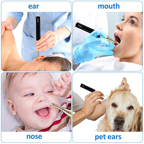 Earwax Removal Endoscope, Earwax Removal Tool, Ear Camera, 1080p FHD Wireless...