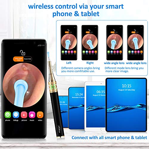 Earwax Removal Endoscope, Earwax Removal Tool, Ear Camera, 1080p FHD Wireless...
