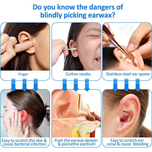 Earwax Removal Endoscope, Earwax Removal Tool, Ear Camera, 1080p FHD Wireless...