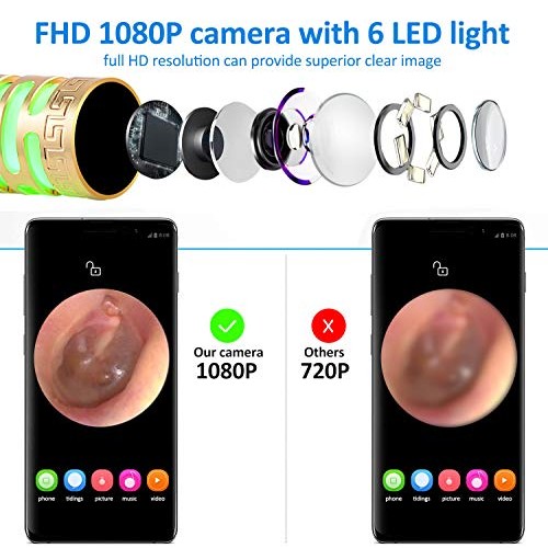 Earwax Removal Endoscope, Earwax Removal Tool, Ear Camera, 1080p FHD Wireless...