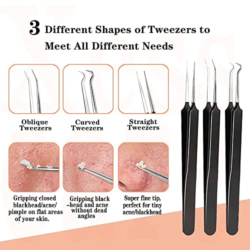 Xesscare Latest Pimple Popper Tool Kit, 16 Pcs Blackhead Remover Tool, Comedo...