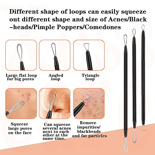Xesscare Latest Pimple Popper Tool Kit, 16 Pcs Blackhead Remover Tool, Comedo...