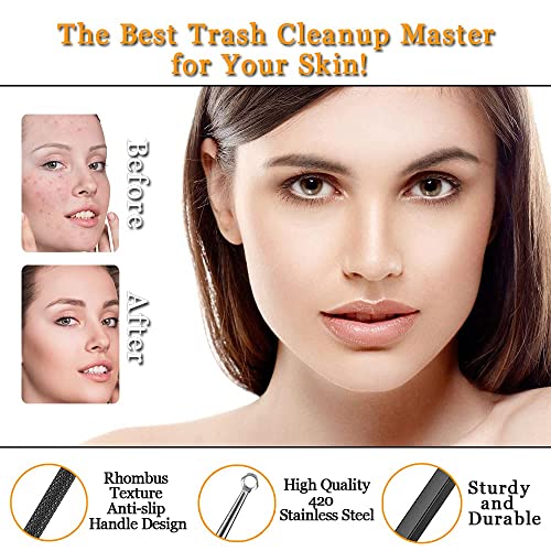 Xesscare Latest Pimple Popper Tool Kit, 16 Pcs Blackhead Remover Tool, Comedo...