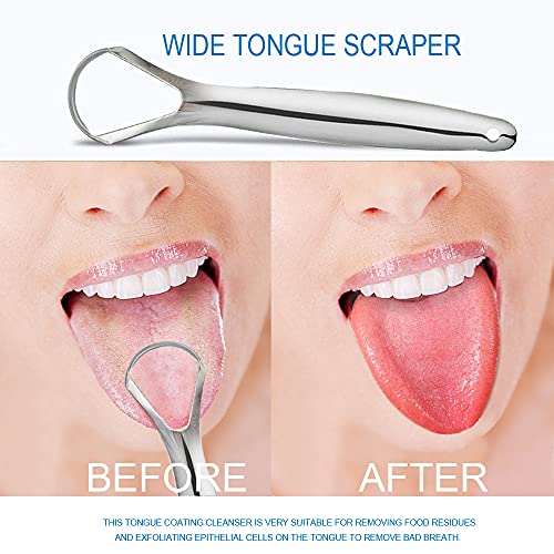 Wide Tongue Scraper, Upgraded Metal Tongue Cleaner(2 Pack) Medical Stainless ...