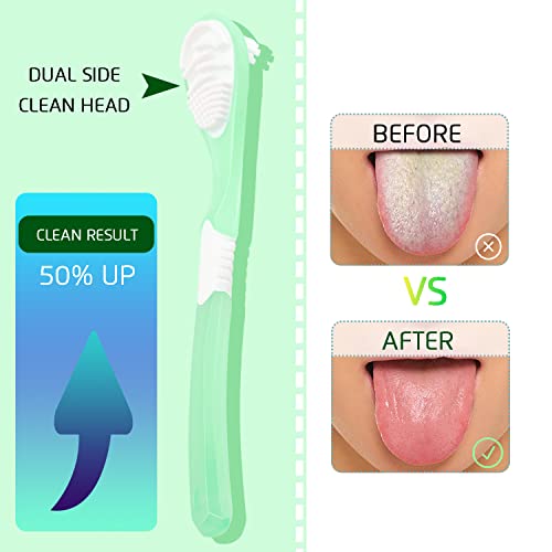 4PCS Tongue Scrapers, Tounge Cleaners, Reduce Bad Breath, Medical Grade Oral ...