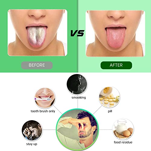 New Tongue Scraper, Premium Tongue Cleaner, Keep Oral Hygiene, Metal Tongue S...