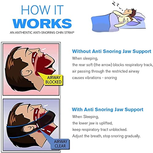 Anti Snoring Chin Strap, Anti Snoring Devices, Snore Stopper,Adjustable Snore...