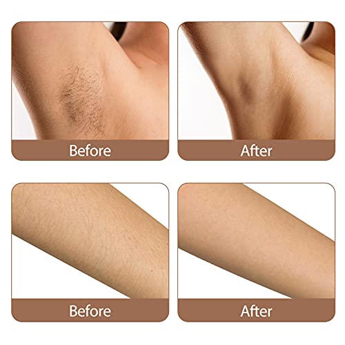 Yachyee Painless Laser Hair Removal Device for Women and Men Permanent with I...