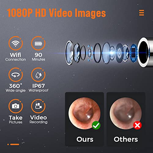 Ear Cleaner with Camera, Ear Wax Removal with 8 Pcs Ear Set, Ear Cleaning Kit...