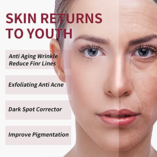 AHA 30% + BHA 2% Peeling Solutions, 30% AHA Glycolic Acid Peel with Lactic Ac...