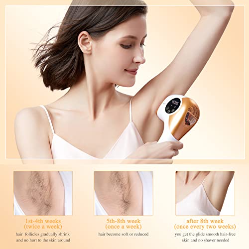 Hair Removal for Women and Men, YAMANGU Permanent Hair Remover with Cooling F...