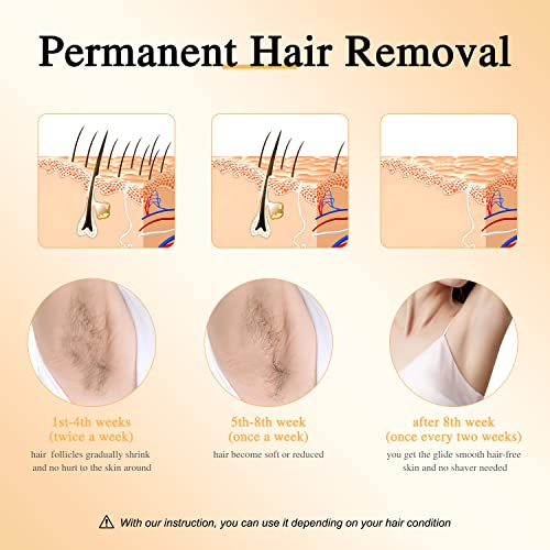 Hair Removal for Women and Men, YAMANGU Permanent Hair Remover with Cooling F...