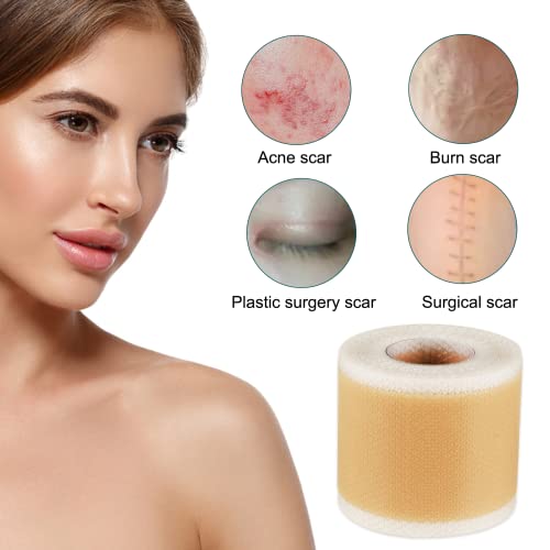 Silicone Scar Sheets (1.6 x 120 Inch), Medical Grade Silicone Scar Tape for S...