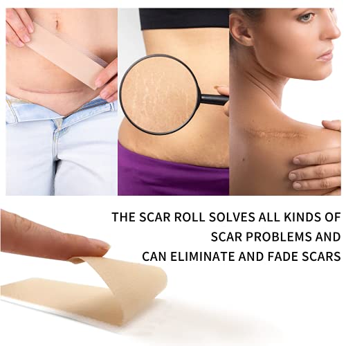 Silicone Scar Sheets (1.6 x 120 Inch), Medical Grade Silicone Scar Tape for S...