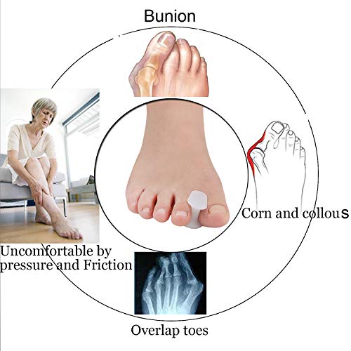 10 Pieces Gel Toe Bunion,Toe Spacers Toe Corrector and Straightener Orthotics...