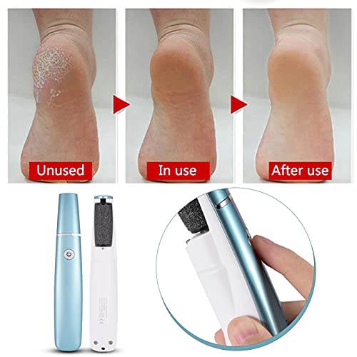 Callus Removal Machine,USB Electric Foot File Hard Skin Remover Pedicure Tool...