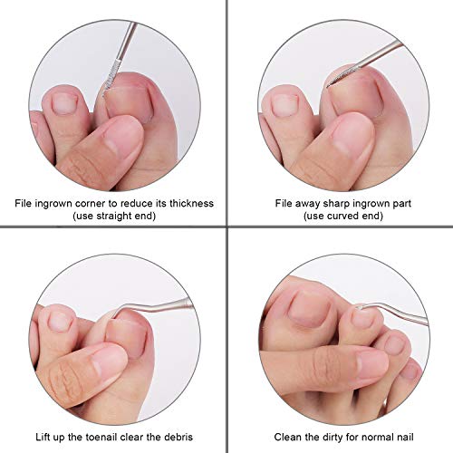 2PCS Ingrown Toenail File and Lifter with Storage Case,YINYIN100% Stainless S...