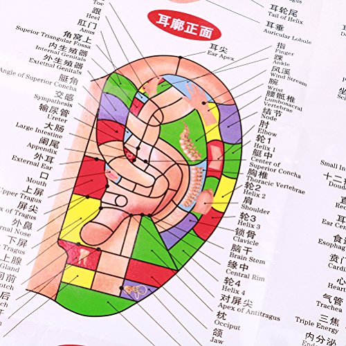 Yiphates 600 Counts Ear Seed Kit, 1Pcs Probe, 1Pcs Acupuncture Chart, 1Pcs Tw...