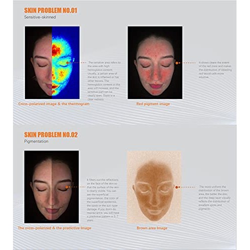 Skin Analyzer Smart AI Digital Skin Analysis Facial Imaging System for Beauty...