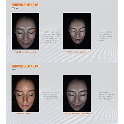 Skin Analyzer Smart AI Digital Skin Analysis Facial Imaging System for Beauty...