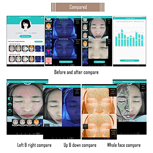 YJF-MRY Portable Skin Diagnosis System Smart Skin Analysis Machine Profession...