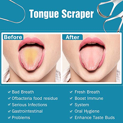 YLYL 3 PCS Metal Tongue Scraper, Tongue Scrapers for Adults Kids, Stainless S...
