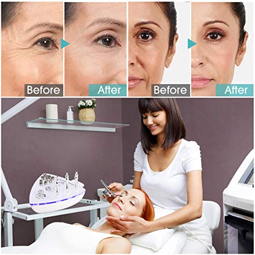 Diamond Microdermabrasion Machine with Spray Gun, Yofuly 65-68cmHg Suction Po...