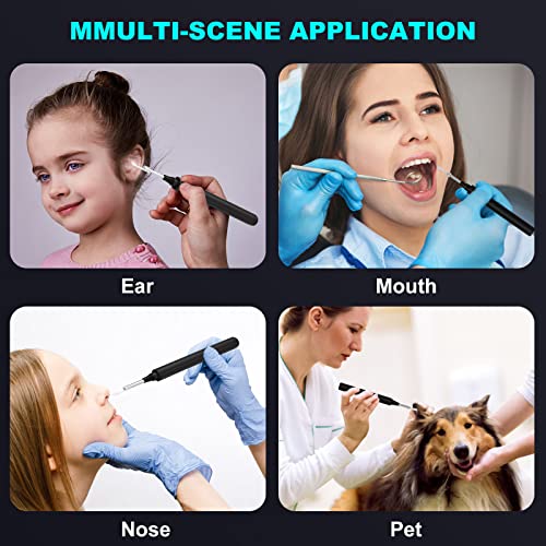 Ear Wax Removal Tool with Camera - Ear Cleaner Kit with 4 Ear Spoon - HD WiFi...