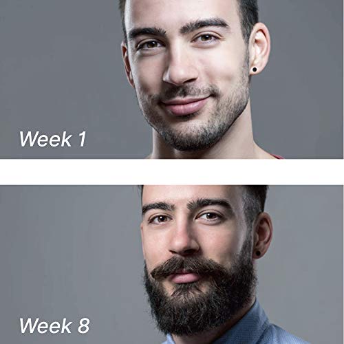 Beard Derma Roller for Beard Growth & Care - Derma Roller for Men - Roller fo...