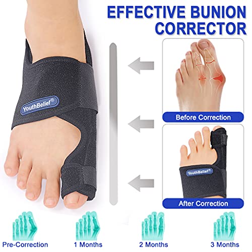 Toe Separator Bunion Corrector Bunion Splint 【2022 Updated】 Hallux Valgus B...