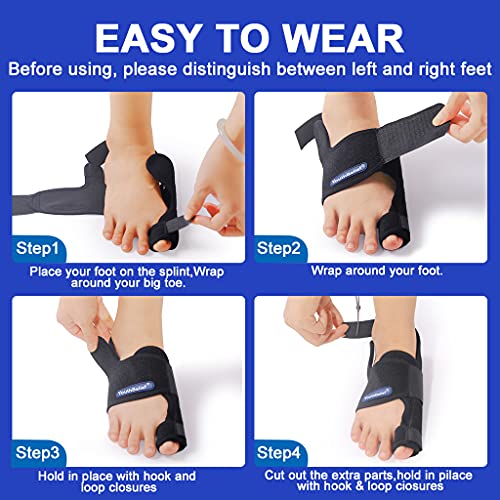 Toe Separator Bunion Corrector Bunion Splint 【2022 Updated】 Hallux Valgus B...