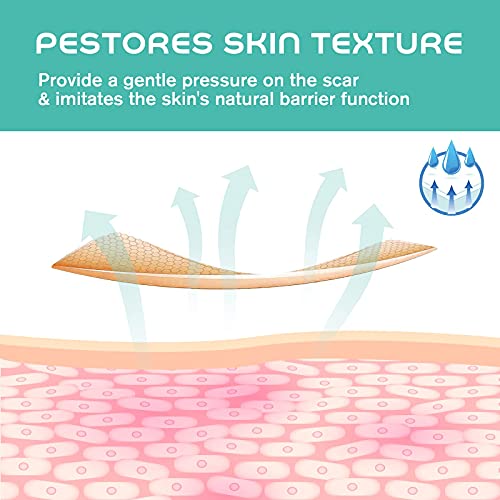 Medical Grade Soft Silicone Tape for Scar Removal (1'' X 70'') Scar Treatment...