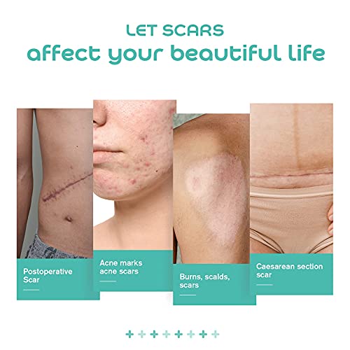 Medical Grade Soft Silicone Tape for Scar Removal (1'' X 70'') Scar Treatment...