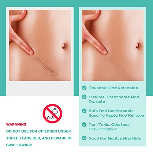 Medical Grade Soft Silicone Tape for Scar Removal (1'' X 70'') Scar Treatment...