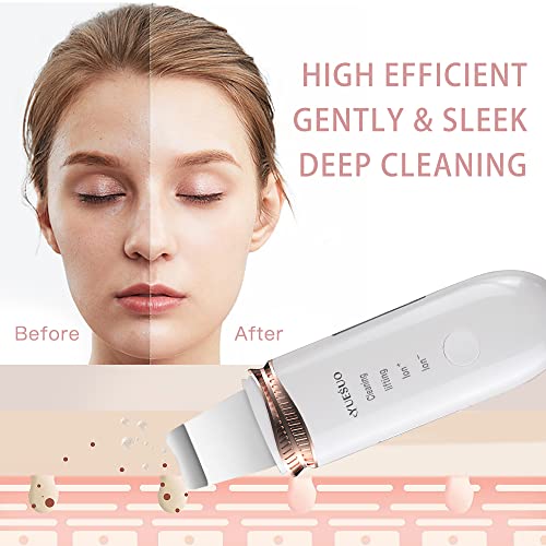Skin Scrubber Face Skin Spatula,Yuesuo Blackhead Remover Pore Cleanser with 4...