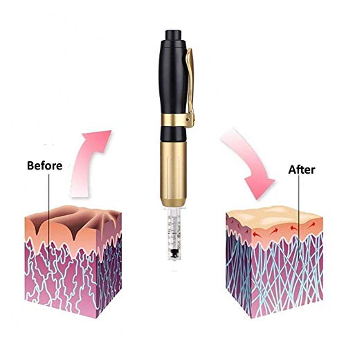 Hyaluron Pen Kit - 0.3/0.5ml Convertible Hyaluronic Acid Syringe Pen, Beauty ...