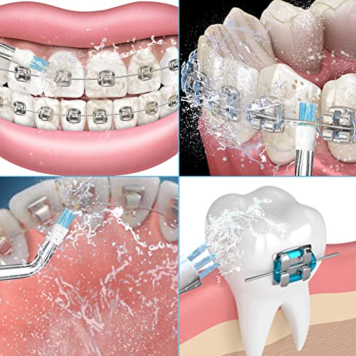 Pack of 5 Plaque Seeker Replacement Tips for Waterpik Water Flosser and Other...