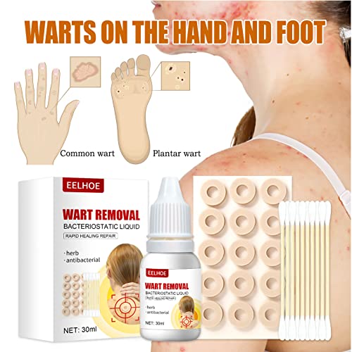 ZCXZ 2Set WartsOff Instant Blemish Removal Set, Skin Tag Remover & Wart Remov...