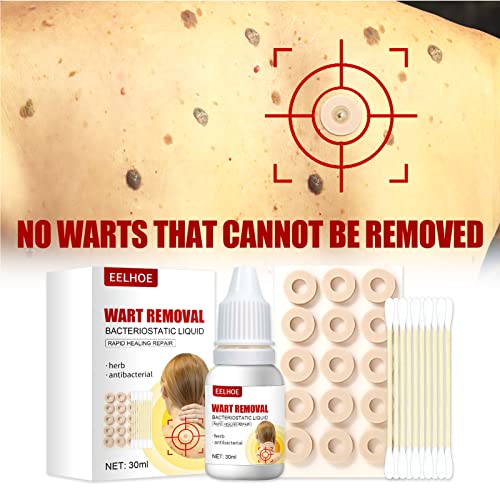 ZCXZ 2Set WartsOff Instant Blemish Removal Set, Skin Tag Remover & Wart Remov...