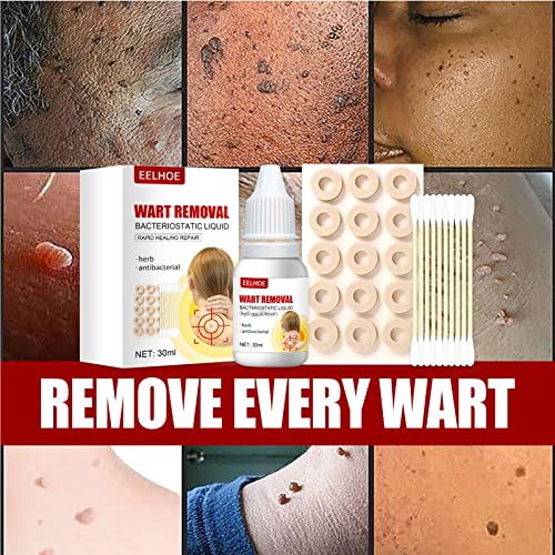 ZCXZ 2Set WartsOff Instant Blemish Removal Set, Skin Tag Remover & Wart Remov...