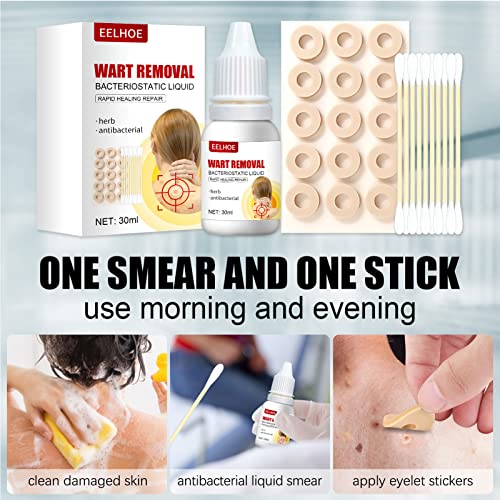 ZCXZ 2Set WartsOff Instant Blemish Removal Set, Skin Tag Remover & Wart Remov...